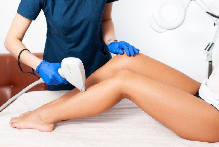 Le laser fonctionne-t-il sur les cheveux blonds ?