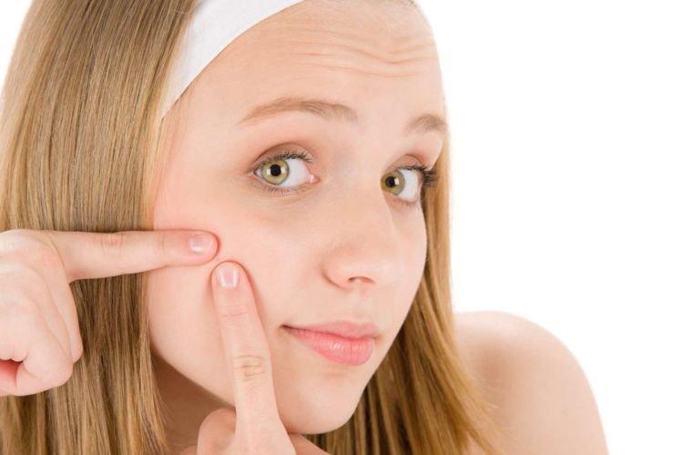 À faire et à ne pas faire - Comment se débarrasser de l'acné sur le visage