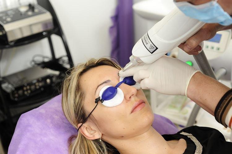 Est-il possible de retirer le maquillage permanent des sourcils