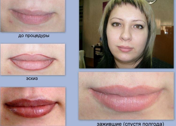 Maquillage permanent des lèvres - photos avant et après