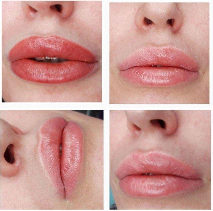 Maquillage permanent des lèvres - photos avant et après