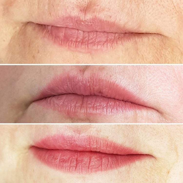 Maquillage permanent des lèvres - photos avant et après