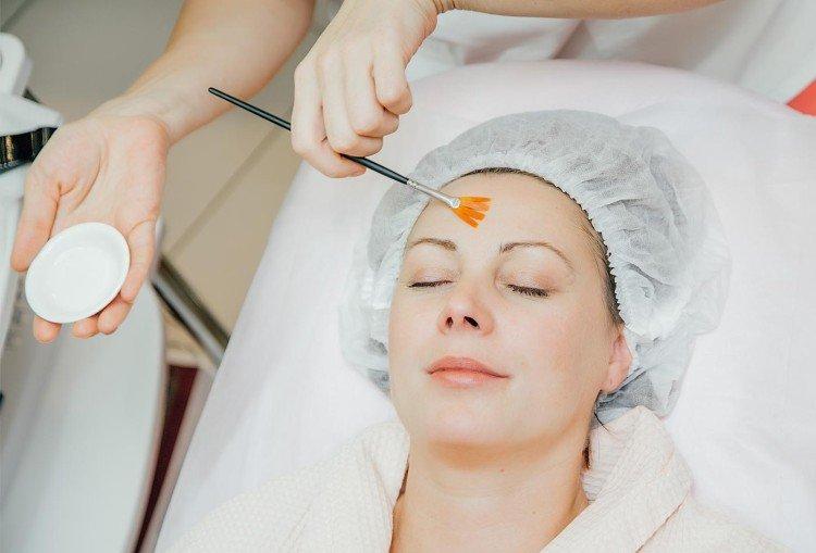 Peeling profond du visage