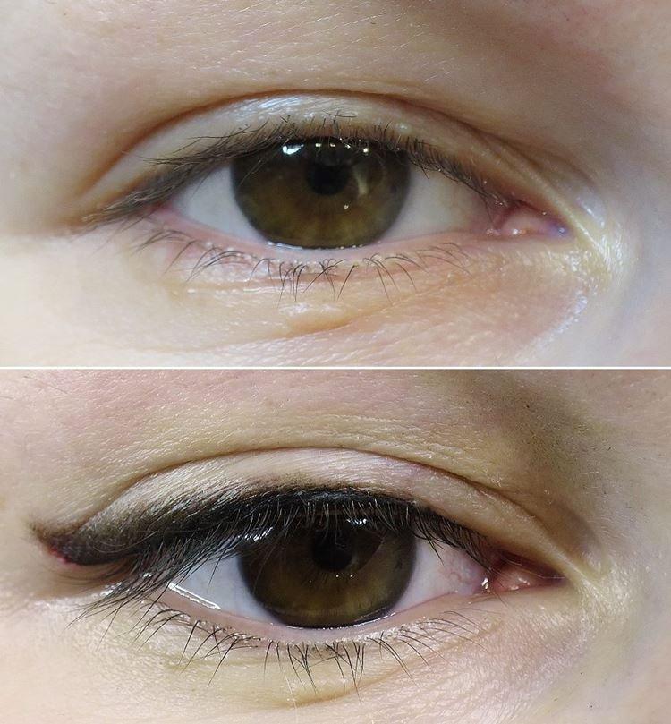 Tatouage des yeux - photos avant et après