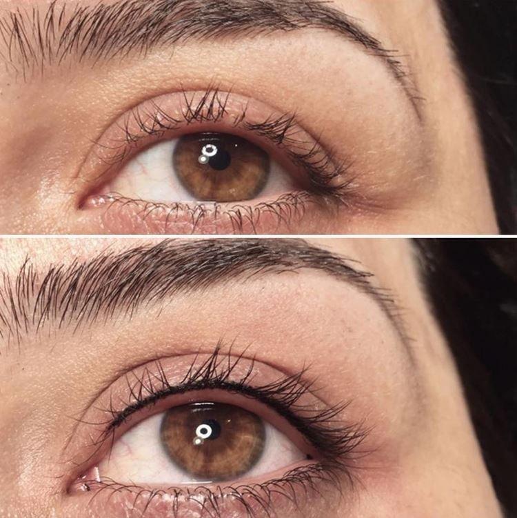 Tatouage des yeux - photos avant et après