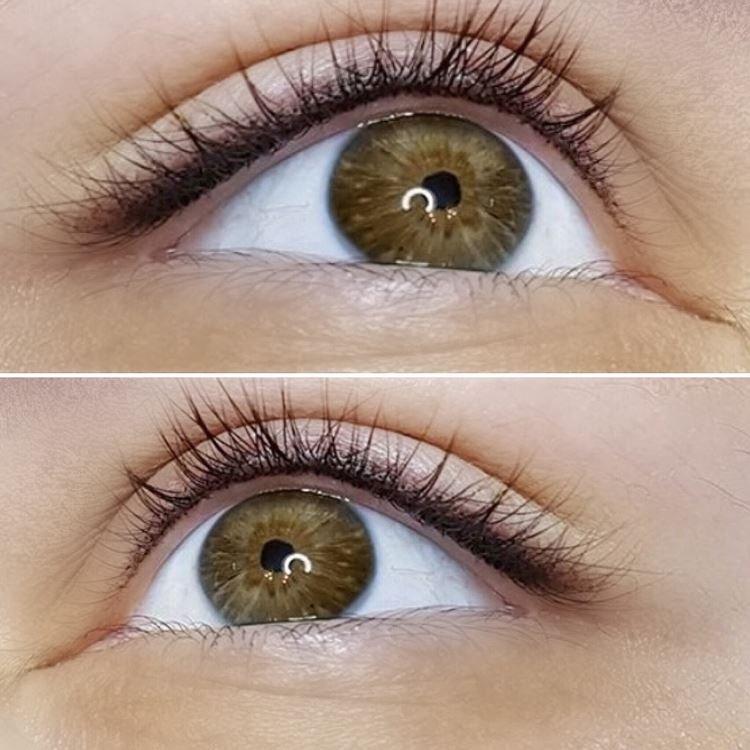 Tatouage des yeux - photos avant et après